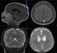 В России разрабатывают программу вживления чипов в мозг человека