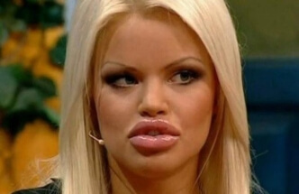 Крупнейший производитель ботокса и филлеров приостанавливает поставки в Россию