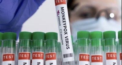 Иммунолог заявил, что оспа обезьян не опасна для россиян